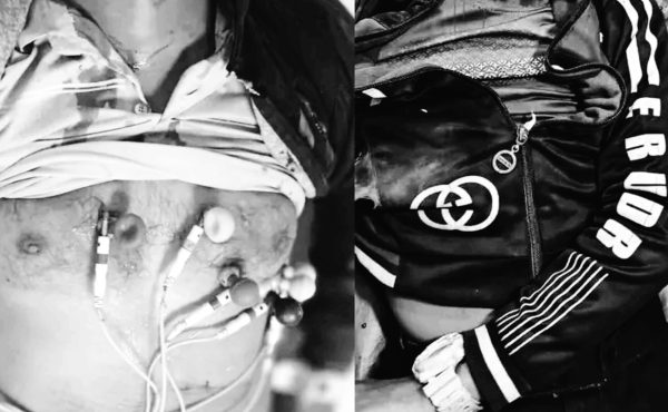 চকরিয়ায় সড়ক দুর্ঘটনায় বাবা ও ছেলের মর্মান্তিক মৃত্যু